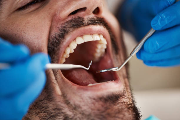 Best Knocked-Out Tooth Emergency  in Level Park Oak Park, MI
