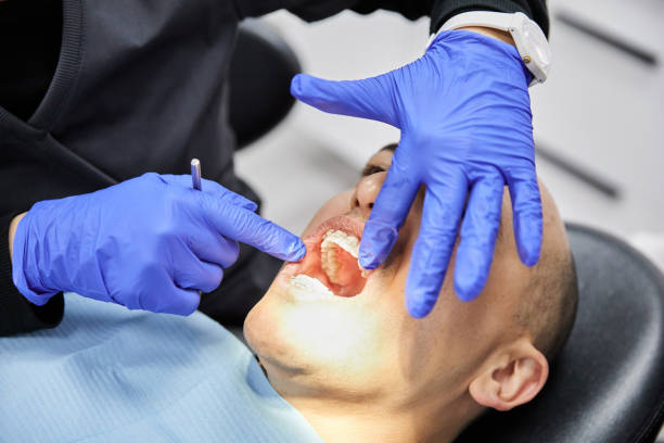 Best Dentist for Tooth Abscess  in Level Park Oak Park, MI